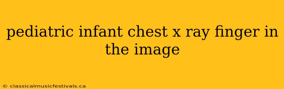 pediatric infant chest x ray finger in the image